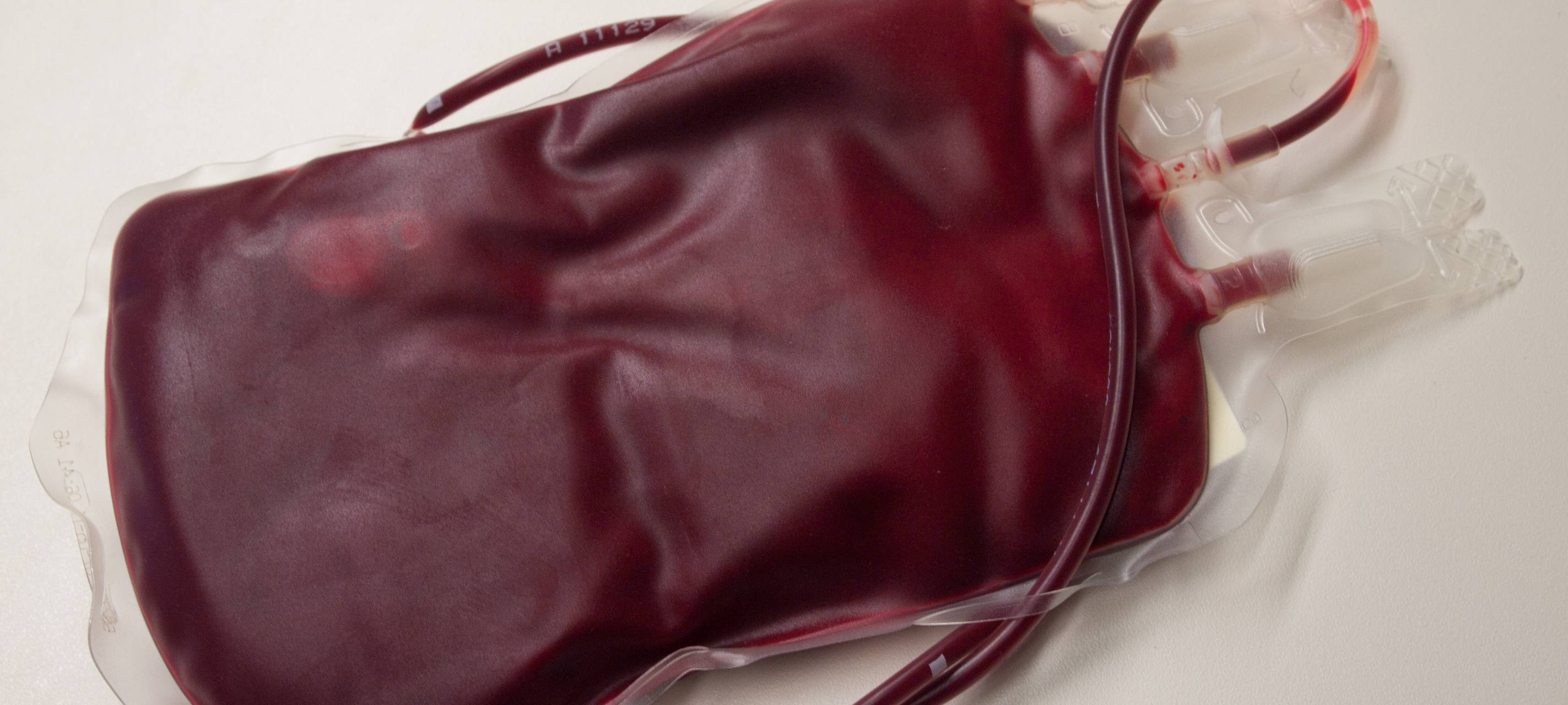 Uni-Klinik Düsseldorf ruft zu Blutspenden auf